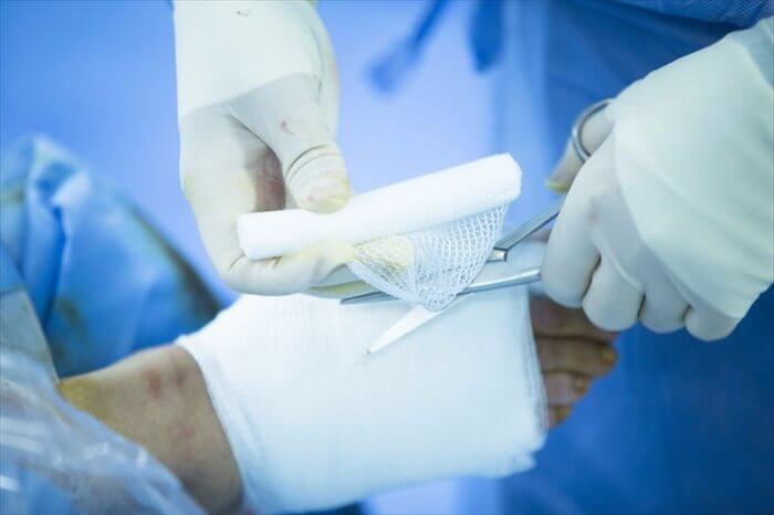 Diabetic Foot Skin Graft - Family Foot and Ankle Care of Greenville