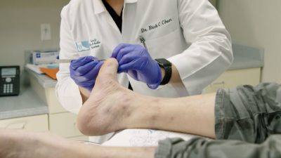 See Your Podiatrist for Callus Removal — Podiatry Group of Annapolis, P.A.